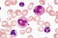 ������ϸ�����׺������մٽ����ʪ�Թؽ��׵ĵ�����