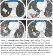 ����PD-1���Ƽ���ؼ����Է���������˼��