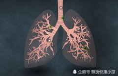 �ΰ��߷���ԭ���ҵ���һ��ҪԶ���⡰��������